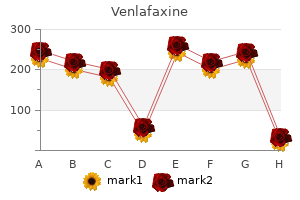 buy 150mg venlafaxine amex