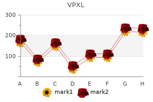 order vpxl with amex