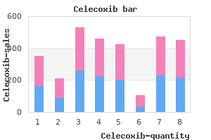 buy genuine celecoxib