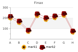 safe finax 1 mg
